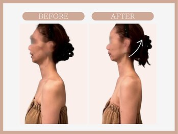 アコガレコガオ 青森店/