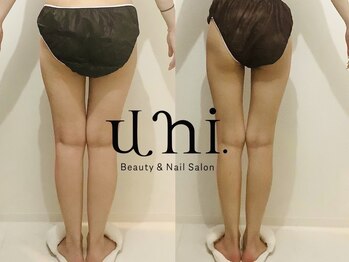 ユニ(uni.)/内腿隙間美脚造形（施術5回)