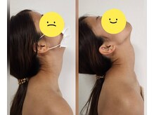 スマイリー(smiley)/