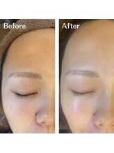 ギルドハナレ(GUILD HANARE)/"ハリとツヤUP"