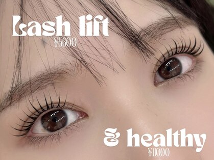 アーラ(Alas)の写真