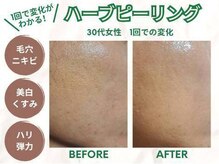 一度でも肌触り・見た目の変化が実感できます★