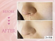 クリアラボ 池袋2nd(Clear Lab)/韓国肌管理&毛穴洗浄専門店