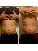 ベラ/筋トレよりお腹が凹む腸もみ♪