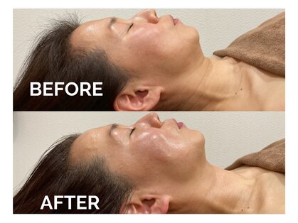 エクラプラス(eclat plus)の写真