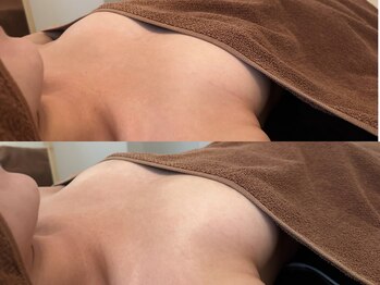 整顔整頭/バストケア