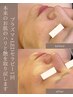 【再来/リフト】小顔維持｜プラズマリフト ¥13200