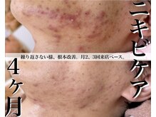 ヴェアリー 広尾(VARY)の雰囲気（諦めがちなあと残り。お任せ下さい。）