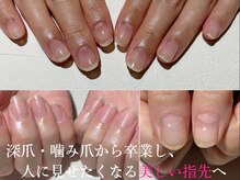 アティックネイルアトリエ(attic nail atelier)