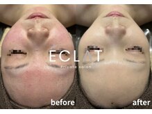 エクラ(ECLAT)