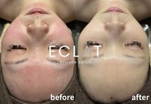 エクラ(ECLAT)