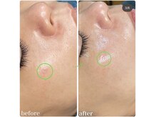 ちらちゅら/クリスティーナ【ビオフィート】