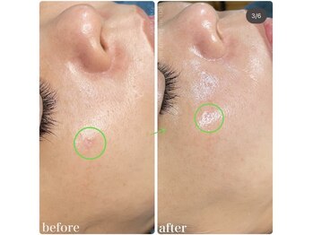 ちらちゅら/クリスティーナ【ビオフィート】