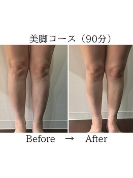 ルース(Luce)/むくみさよなら《美脚コース》