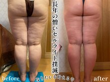 ジャミーラ(JAMIL)の雰囲気（凹凸セル改善はJAMIL大得意！どんな頑固な凹凸セルもお任せを！）