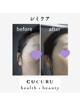 ククルヘルスビューティー(CUCURU health×beauty)/10分取り放題シミケアパック付き