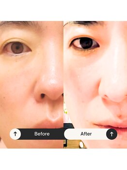 ゆう/ビフォーアフター