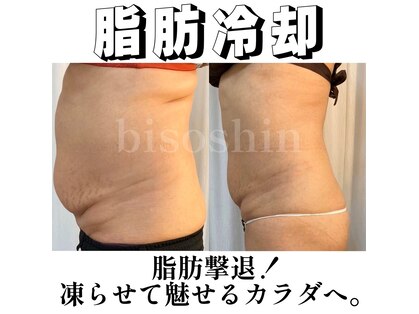 美痩身(bisoshin)の写真