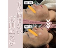 レアナ(LEANA)の雰囲気（ビフォーアフター★驚きの結果★）