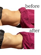 ミースリーズ(methrees)/お通じのお悩みにも【腸もみ】