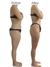 リカバリー(&recovery)/中半身のモタつきrecovery