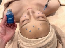 リディエイト(radiate.)