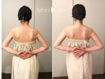 アマリエ/繰り返す肩こりを改善