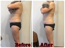 メリンダ(Merinda)/リンパ×セル脂肪ケア×筋膜ケア