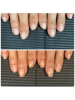 ウェルズユキ(well's yuki)/爪の形変えたい