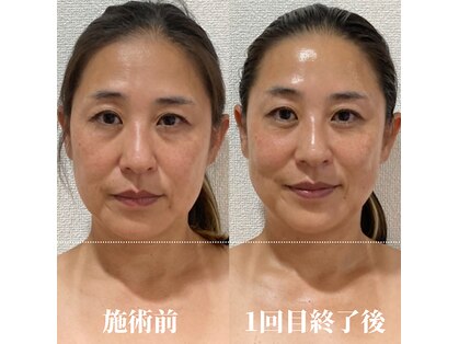 ロータス ビューティー(LOTUS Beauty)の写真