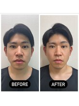 堺整骨院 小郡院/小顔矯正