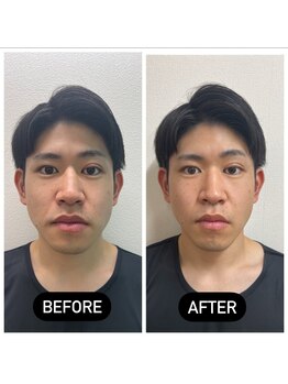 堺整骨院 小郡院/小顔矯正