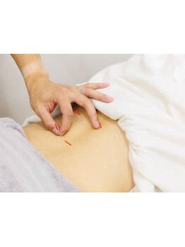 接骨院・整骨院で施術を受けたい