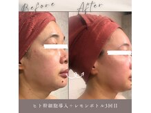 サンテボーテ(Sante Beaute)