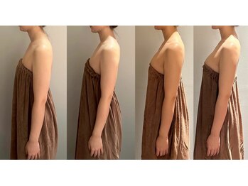 ロココ 豊田店(Rococo)/ビフォーアフター