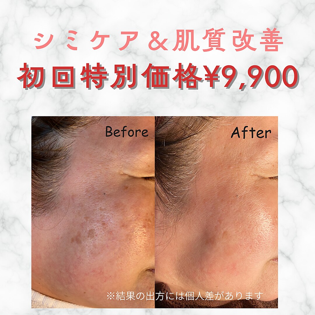 美シェリ(美Cheri)｜ホットペッパービューティー