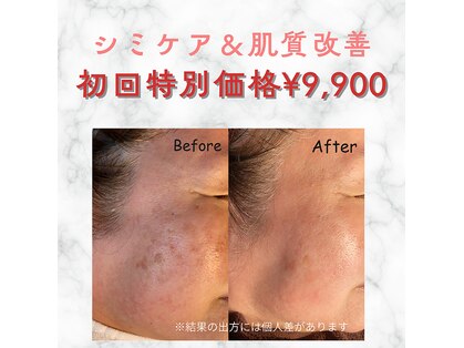 美シェリ(美Cheri)の写真