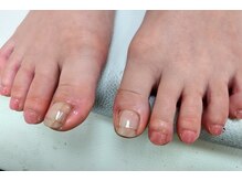 キープ ネイルサロン(KEEP)/チェックアート～フット～