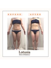 ルトゥーシア(Lotusia)/全身　before→after