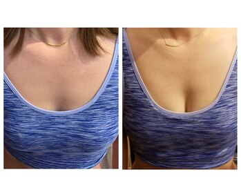 ししまる骨盤整体院 一宮院/バストケア