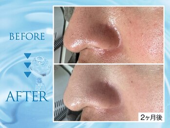 クリアラボ 錦糸町(Clear Lab)/韓国肌管理&毛穴洗浄専門店