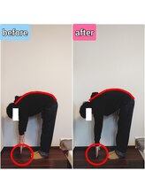 エンビジョン(ENVISION)/before→after