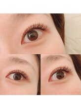 マニプーラ(Manipura)/