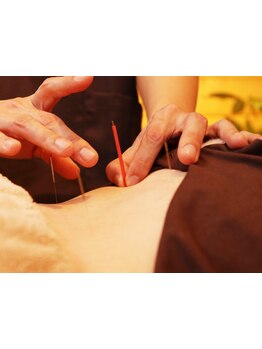 鍼灸施術を受けたい