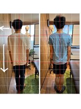 アウル 鳳店(OWL)/姿勢矯正ビフォーアフター