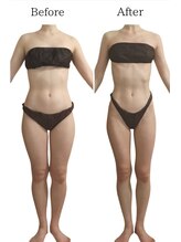 リカバリー(&recovery)/ダイエットrecovery/骨洗浄