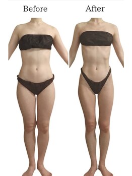 リカバリー(&recovery)/ダイエットrecovery/骨洗浄