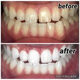 ホワイトニングビューティー 東陽町