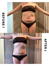 パーソナルデトックスサロン エヌ(N)/何をしても【痩せない】アナタに