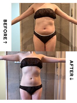 パーソナルデトックスサロン エヌ(N)/何をしても【痩せない】アナタに